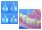 Kit of Premolar and Molar Transparent Contoured Matrices 1.092 (120 pcs.)