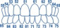 Deciduous transparent crowns 1.912 (64 pcs.)