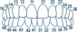 Molar transparent crowns 1.911M (40 pcs.)